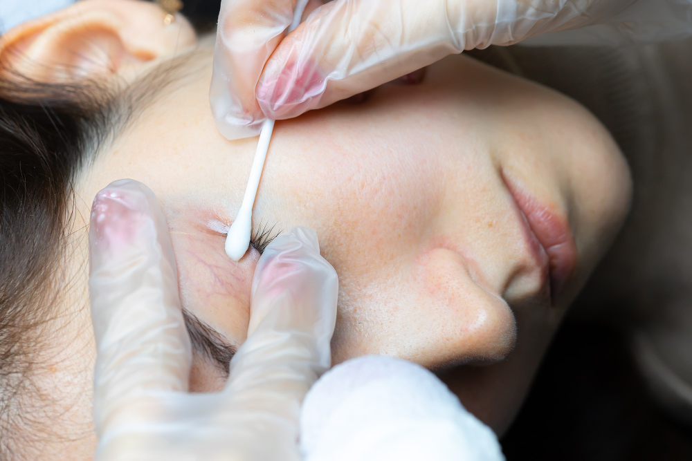 Remove Eyelashes